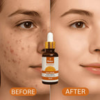 Relax UK Vitamin C Face Serum 30ml glow & balancing Skin Tone, Reducing Skin Aging